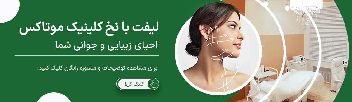 لیفت با نخ