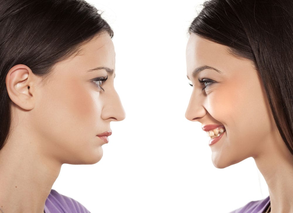 کوچک کردن بینی با لیزر