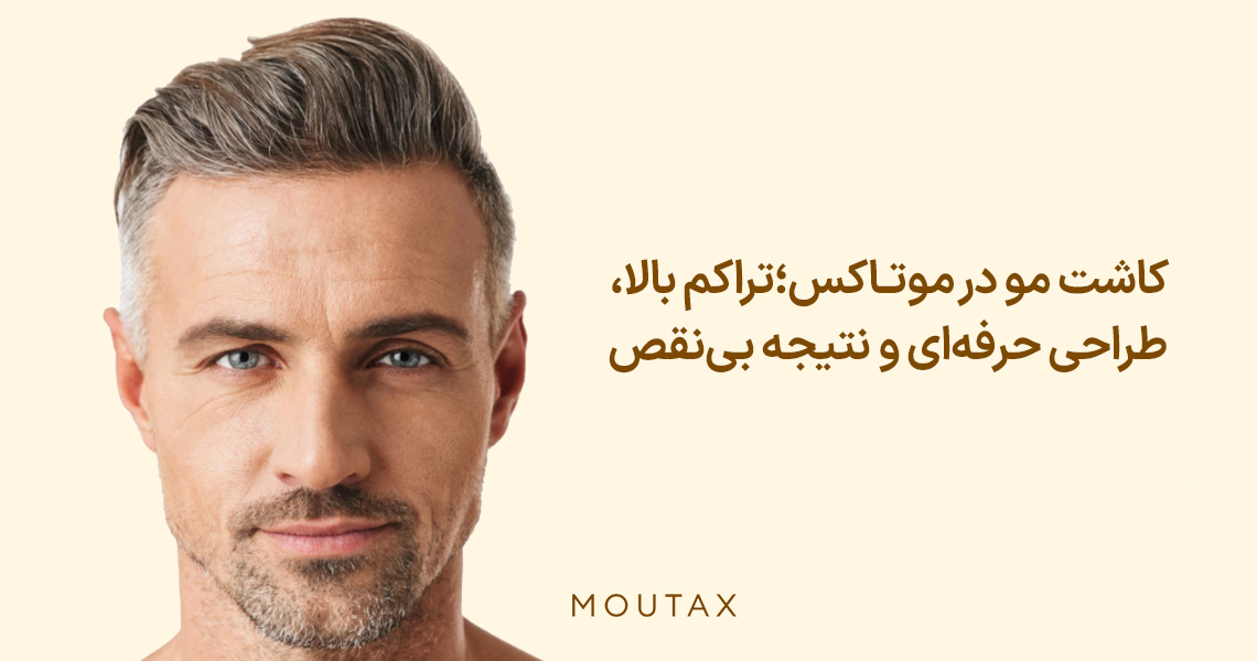 بهترین مرکز کاشت مو تهران