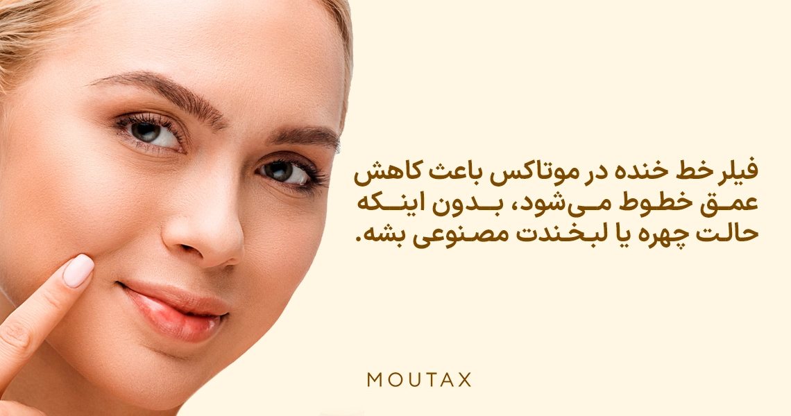 تزریق فیلر برای خط خنده
