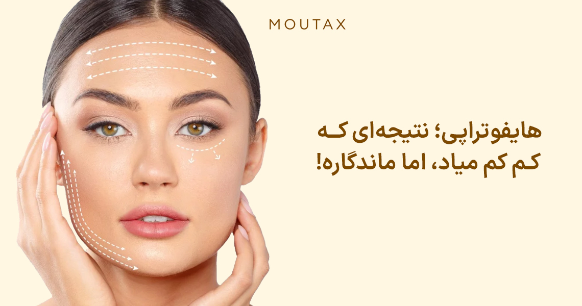 قیمت هایفوتراپی صورت