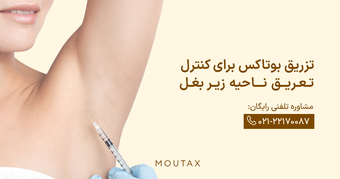 تزریق بوتاکس به زیربغل